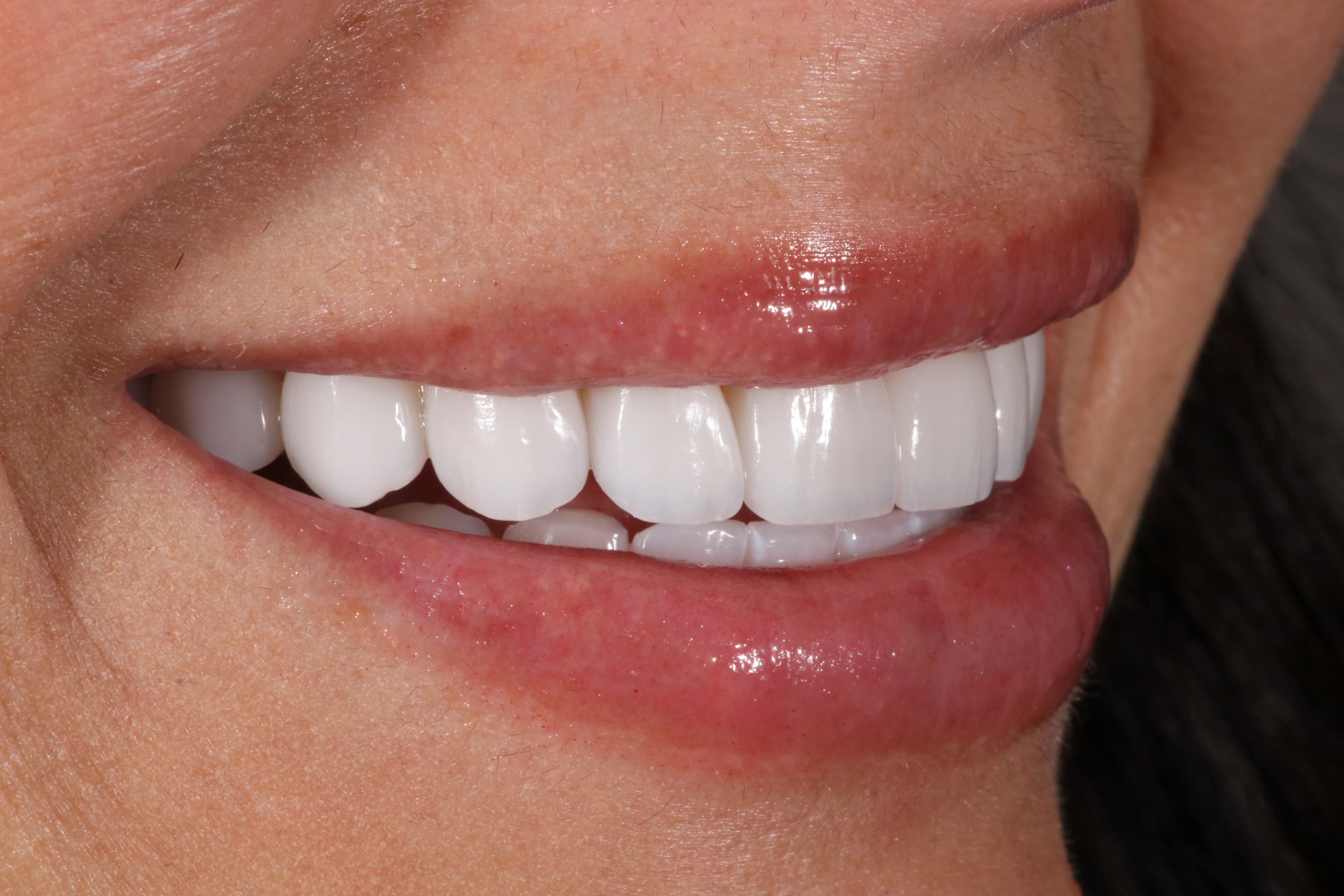 Beautiful radiant smile