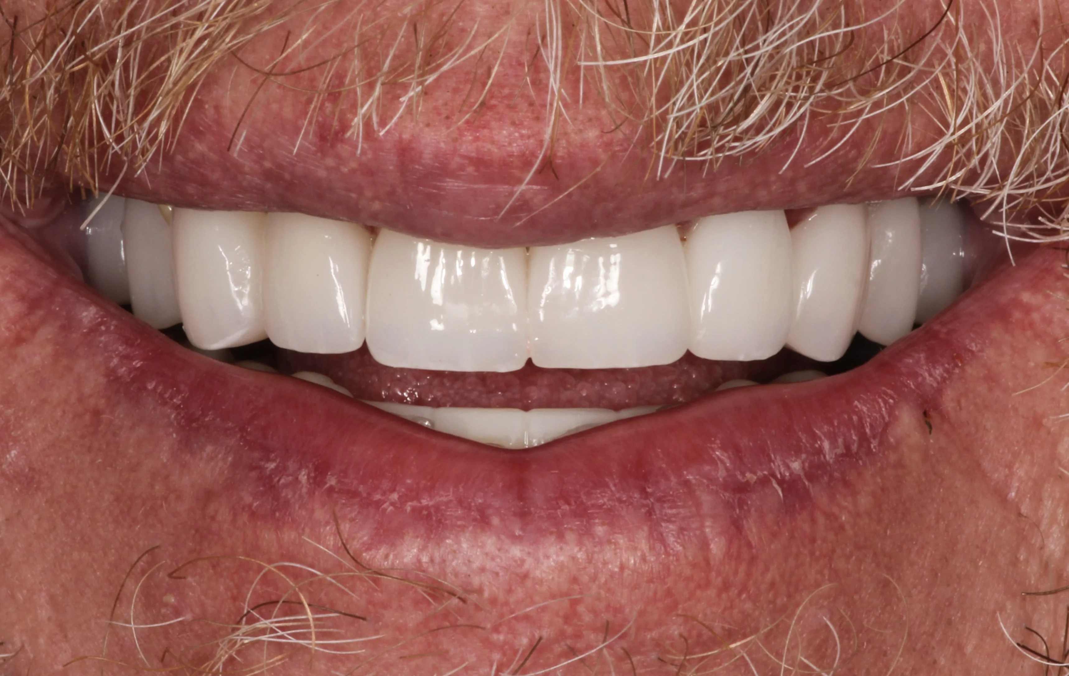 Smile Gallery | Power Ranch Dental