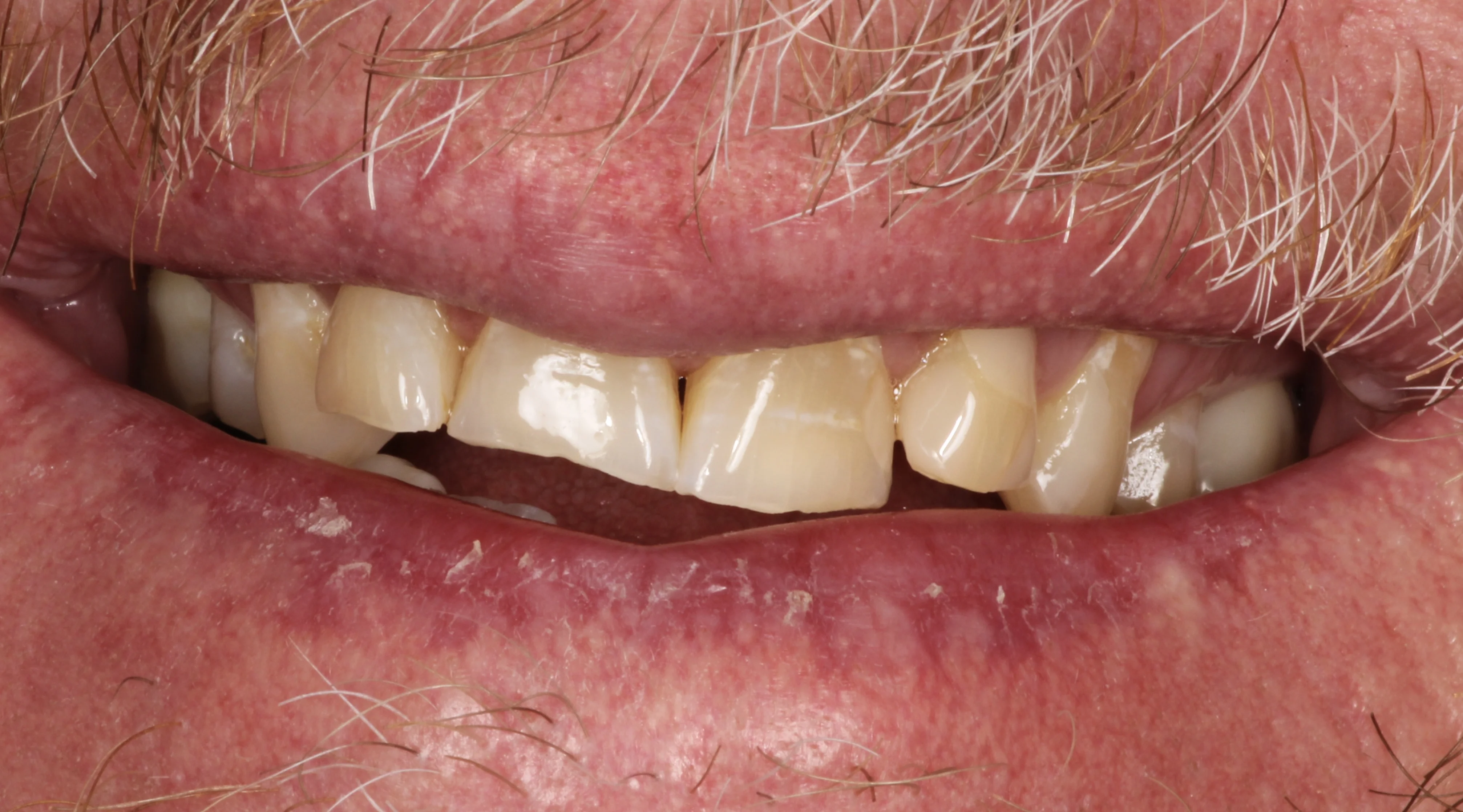 Smile Gallery | Power Ranch Dental